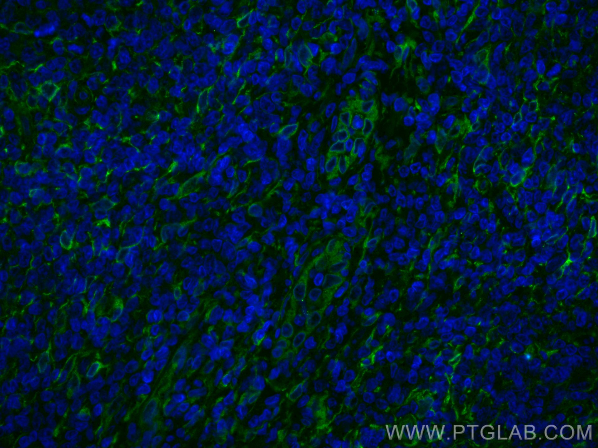 IF Staining of human tonsillitis using CL488-80165