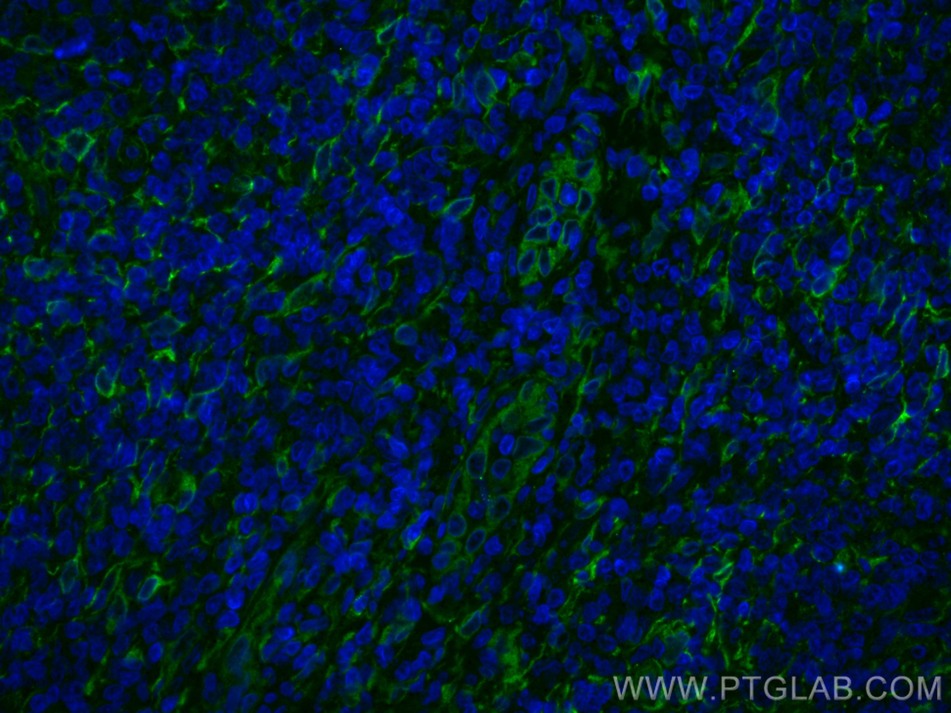 Immunofluorescence (IF) / fluorescent staining of human tonsillitis tissue using CoraLite® Plus 488-conjugated TMEM173/STING Recomb (CL488-80165)