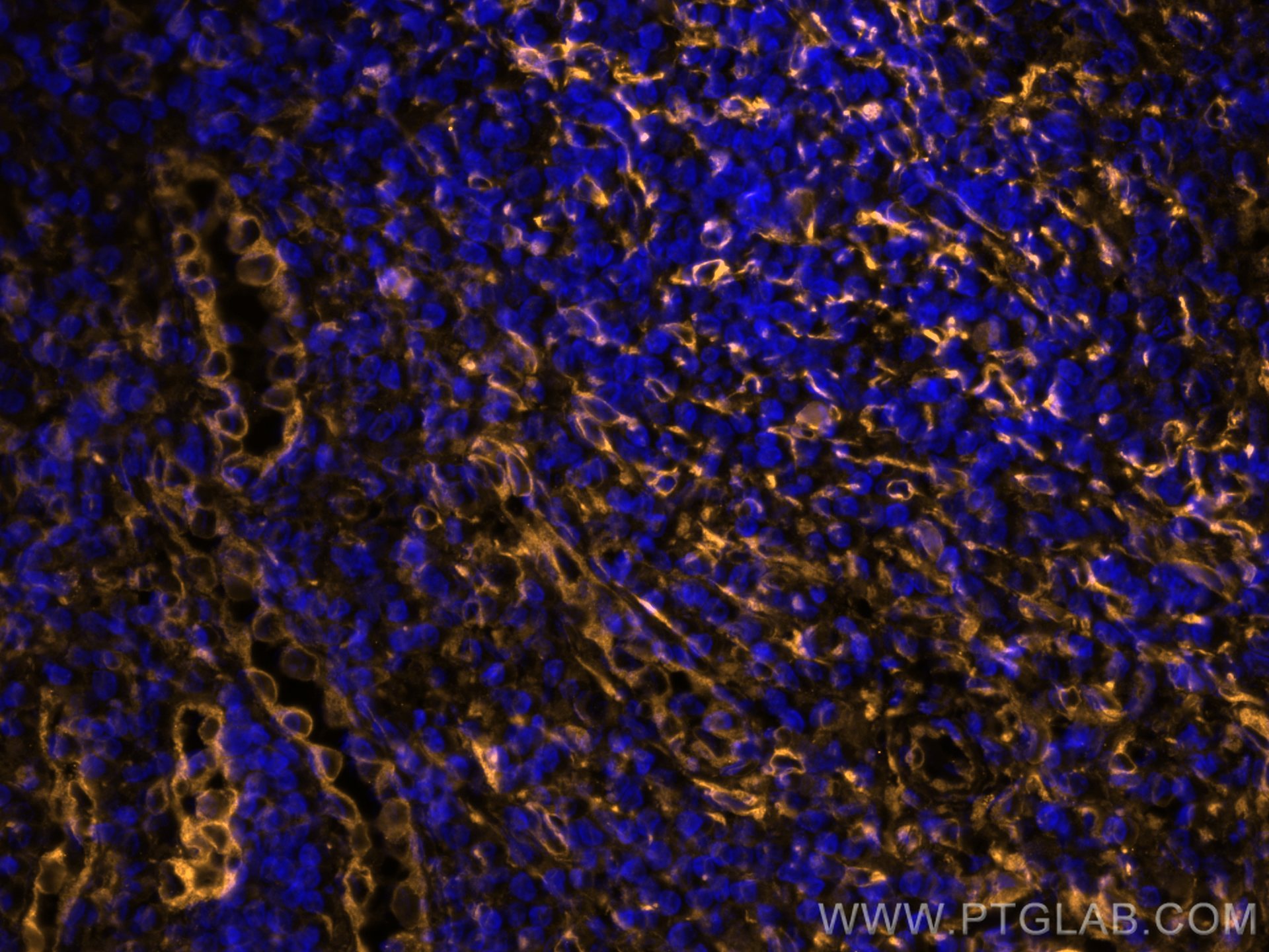IF Staining of human tonsillitis using CL555-80165