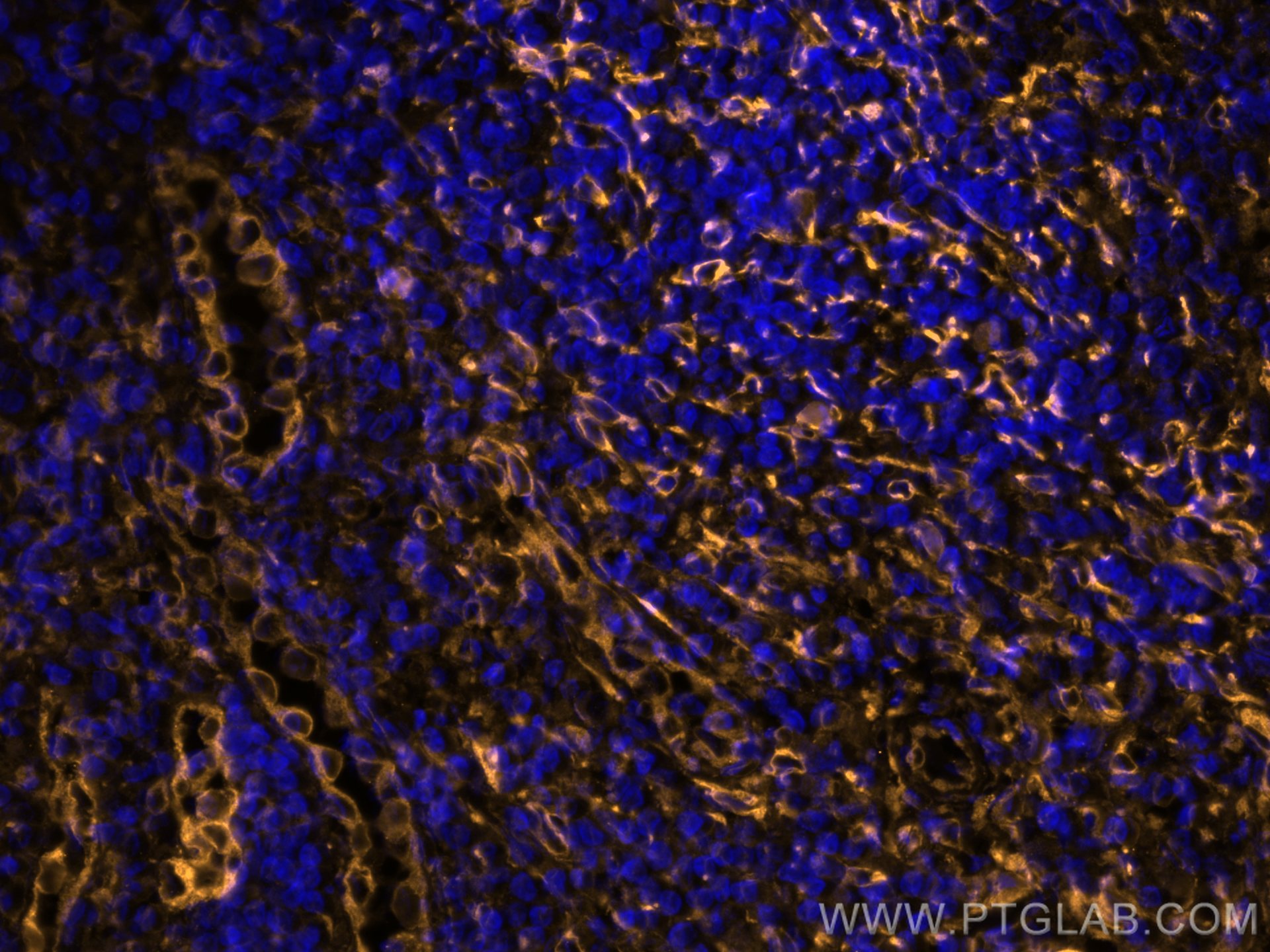 Immunofluorescence (IF) / fluorescent staining of human tonsillitis tissue using CoraLite®555-conjugated TMEM173/STING Recombinant  (CL555-80165)