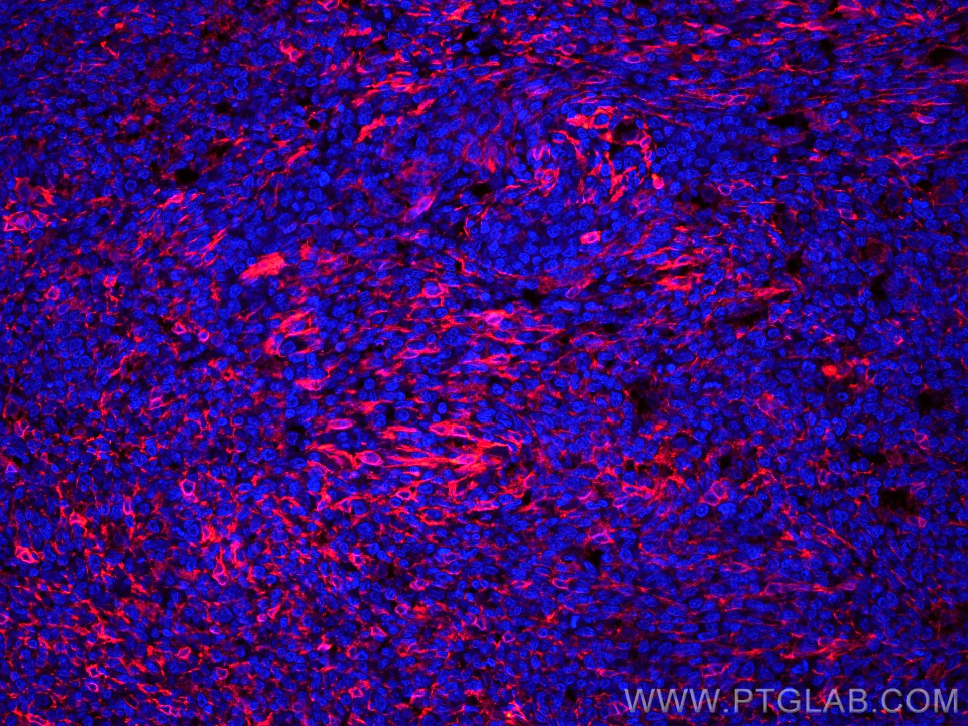 Immunofluorescence (IF) / fluorescent staining of human tonsillitis tissue using CoraLite®594-conjugated TMEM173/STING Polyclonal a (CL594-19851)