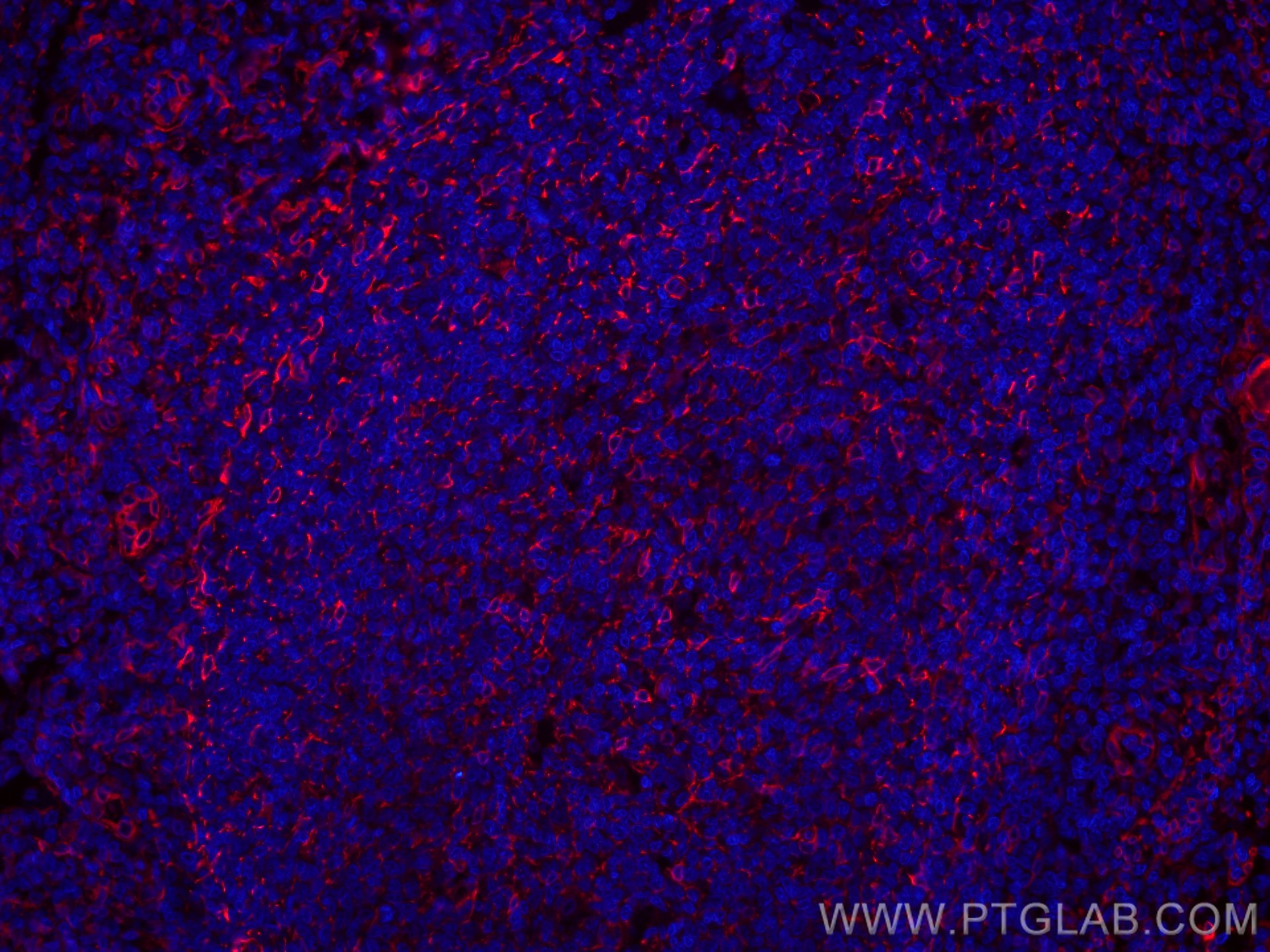 Immunofluorescence (IF) / fluorescent staining of human tonsillitis tissue using CoraLite®594-conjugated TMEM173/STING Recombinant  (CL594-80165)