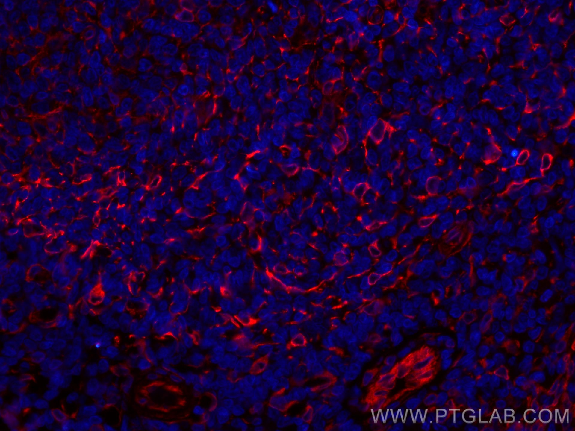 Immunofluorescence (IF) / fluorescent staining of human tonsillitis tissue using CoraLite®594-conjugated TMEM173/STING Recombinant  (CL594-80165)