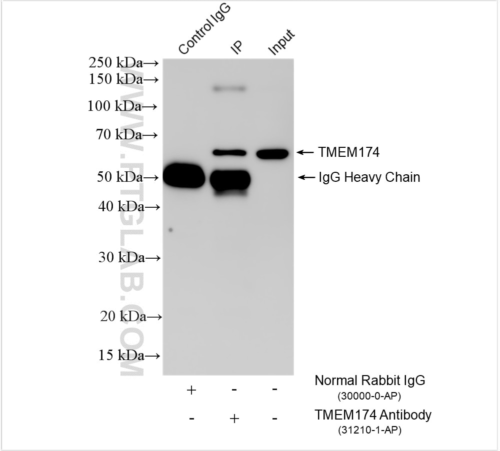 Immunoprecipitation (IP) experiment of Jurkat cells using TMEM174 Polyclonal antibody (31210-1-AP)