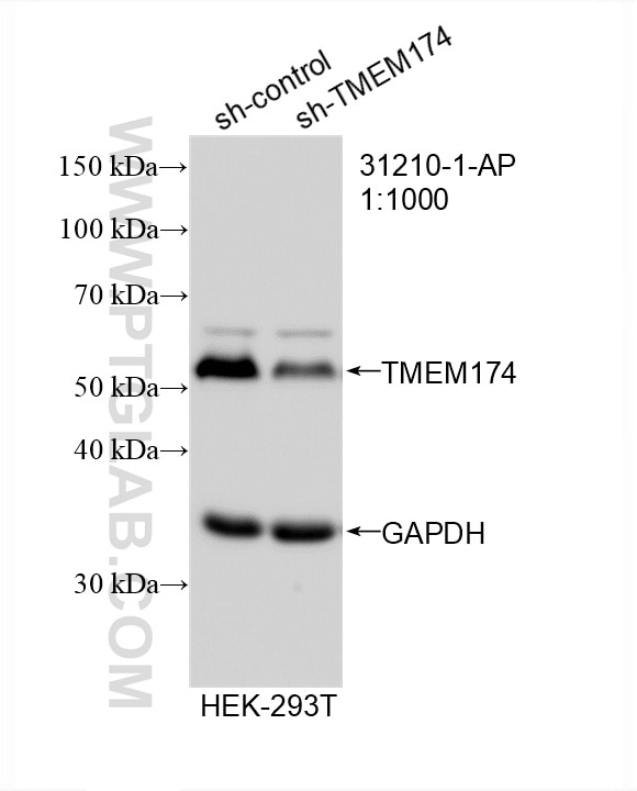 Western Blot (WB) analysis of HEK-293T cells using TMEM174 Polyclonal antibody (31210-1-AP)