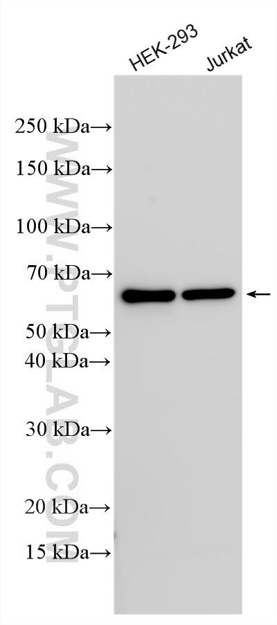 Western Blot (WB) analysis of various lysates using TMEM174 Polyclonal antibody (31210-1-AP)