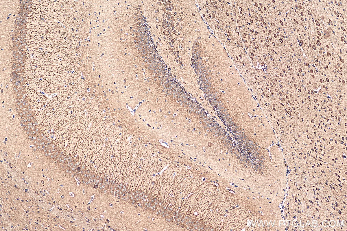 Immunohistochemistry (IHC) staining of mouse brain tissue using TMEM175 Polyclonal antibody (19925-1-AP)