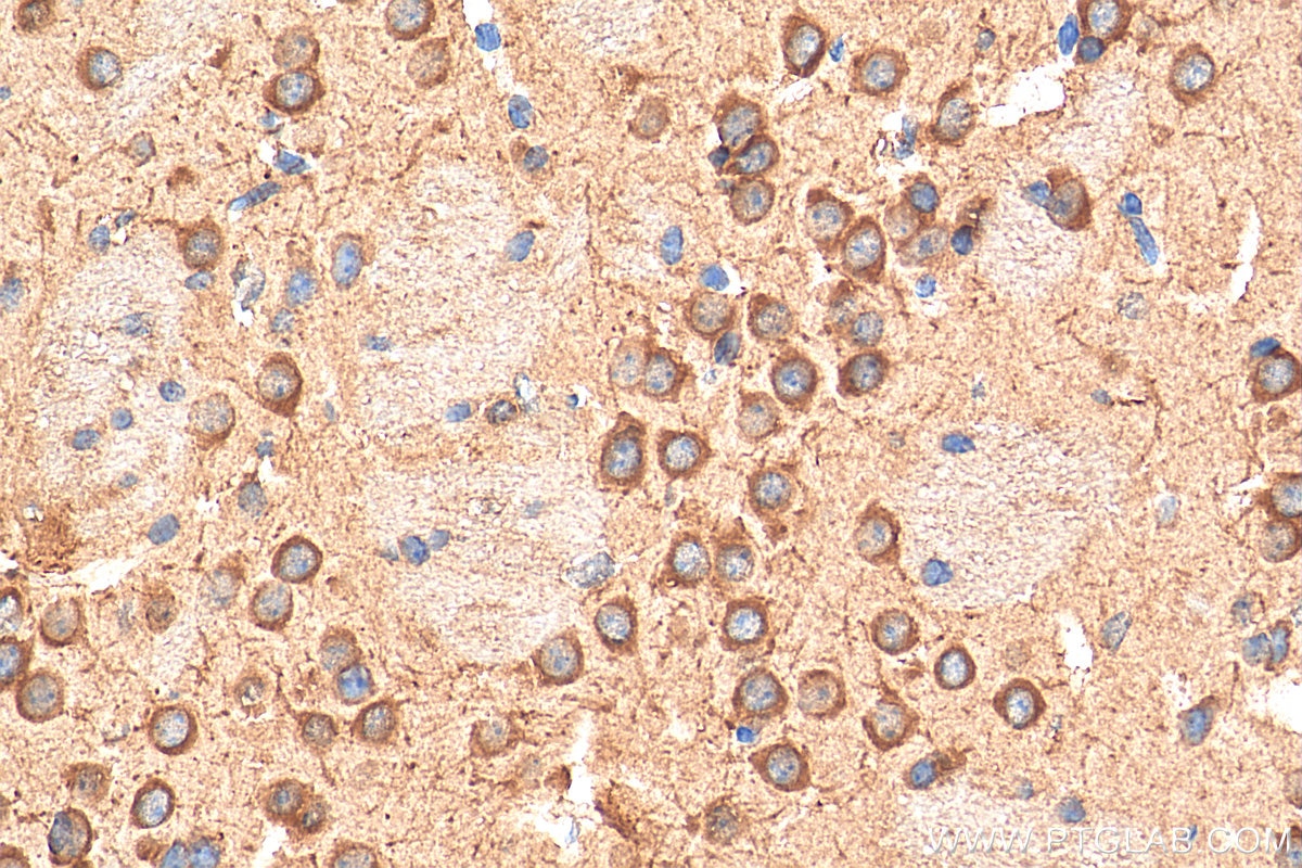 Immunohistochemistry (IHC) staining of mouse brain tissue using TMEM175 Polyclonal antibody (19925-1-AP)