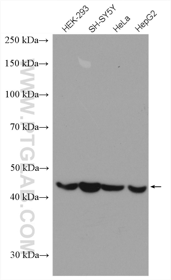 Western Blot (WB) analysis of various lysates using TMEM175 Polyclonal antibody (19925-1-AP)