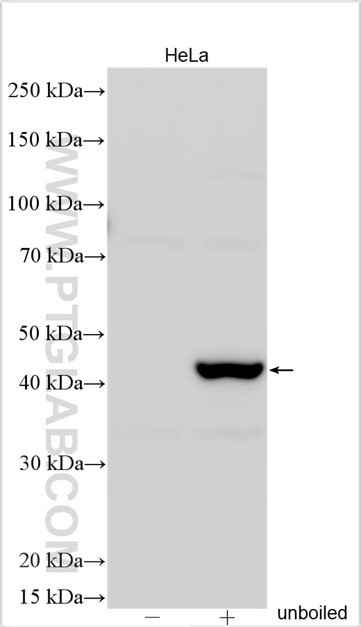 Western Blot (WB) analysis of various lysates using TMEM175 Polyclonal antibody (19925-1-AP)