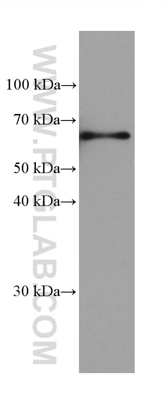 Western Blot (WB) analysis of pig liver tissue using TMEM175 Monoclonal antibody (68172-1-Ig)