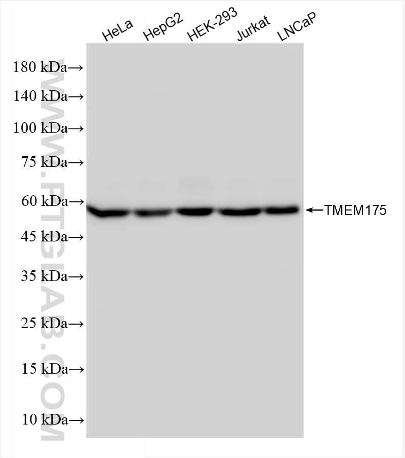 Western Blot (WB) analysis of various lysates using TMEM175 Recombinant antibody (84554-1-RR)