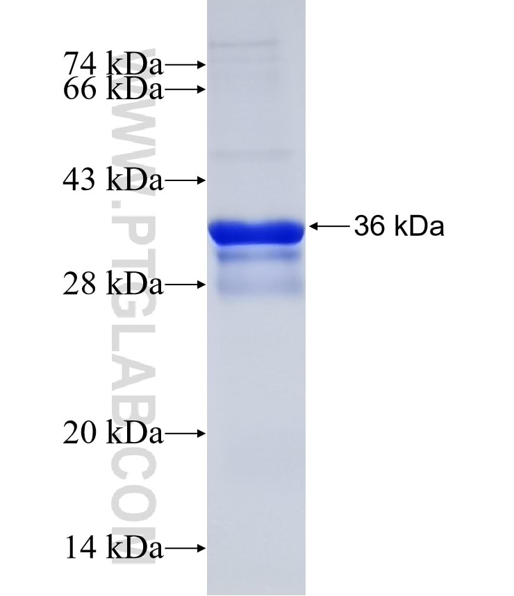 TMEM175 fusion protein Ag13890 SDS-PAGE