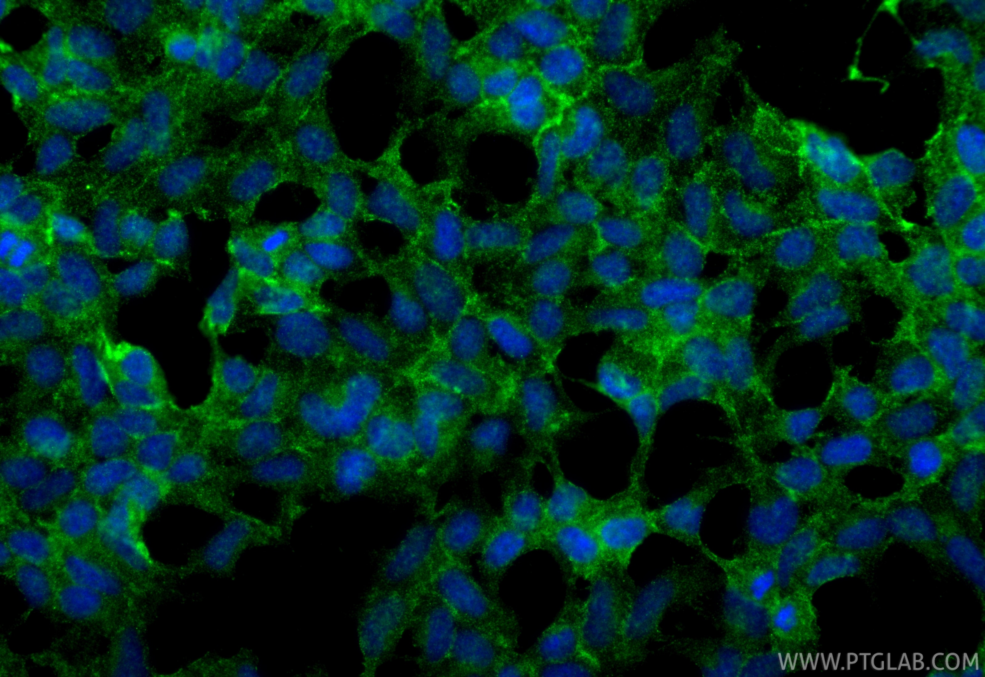 Immunofluorescence (IF) / fluorescent staining of HEK-293 cells using TMEM176A Polyclonal antibody (20378-1-AP)