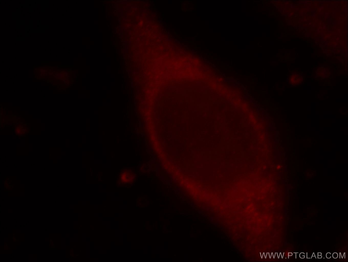 Immunofluorescence (IF) / fluorescent staining of HeLa cells using TMEM176A Polyclonal antibody (20378-1-AP)