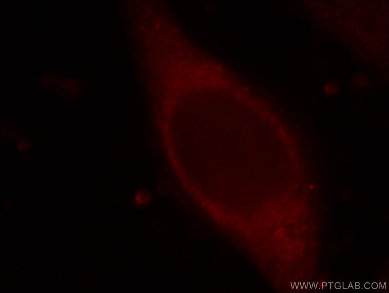 Immunofluorescence (IF) / fluorescent staining of HeLa cells using TMEM176A Polyclonal antibody (20378-1-AP)