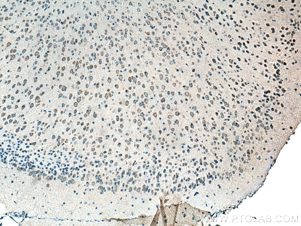 Immunohistochemistry (IHC) staining of mouse brain tissue using TMEM176A Polyclonal antibody (20378-1-AP)