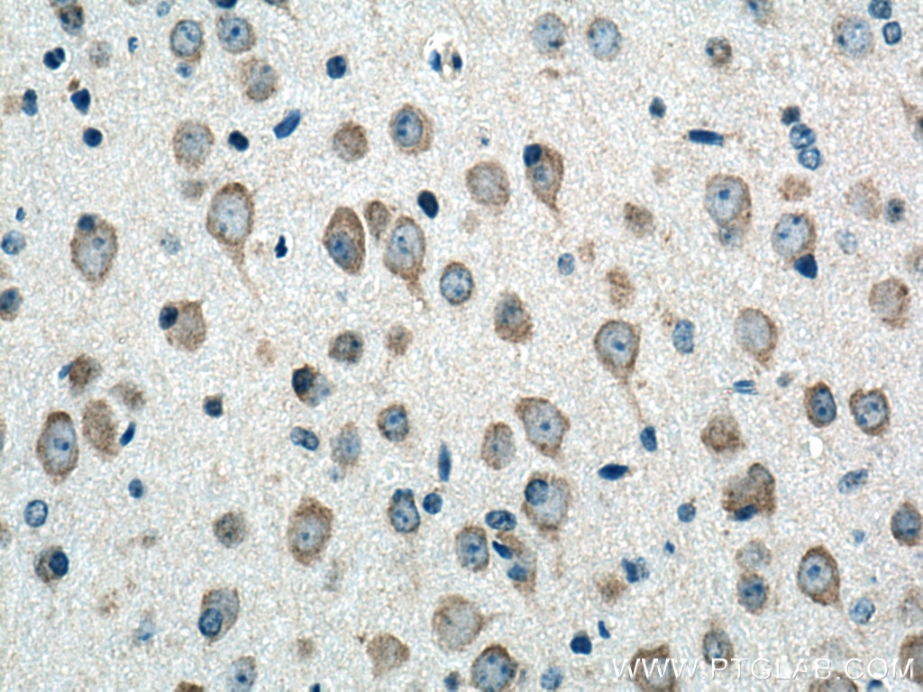 Immunohistochemistry (IHC) staining of mouse brain tissue using TMEM176A Polyclonal antibody (20378-1-AP)