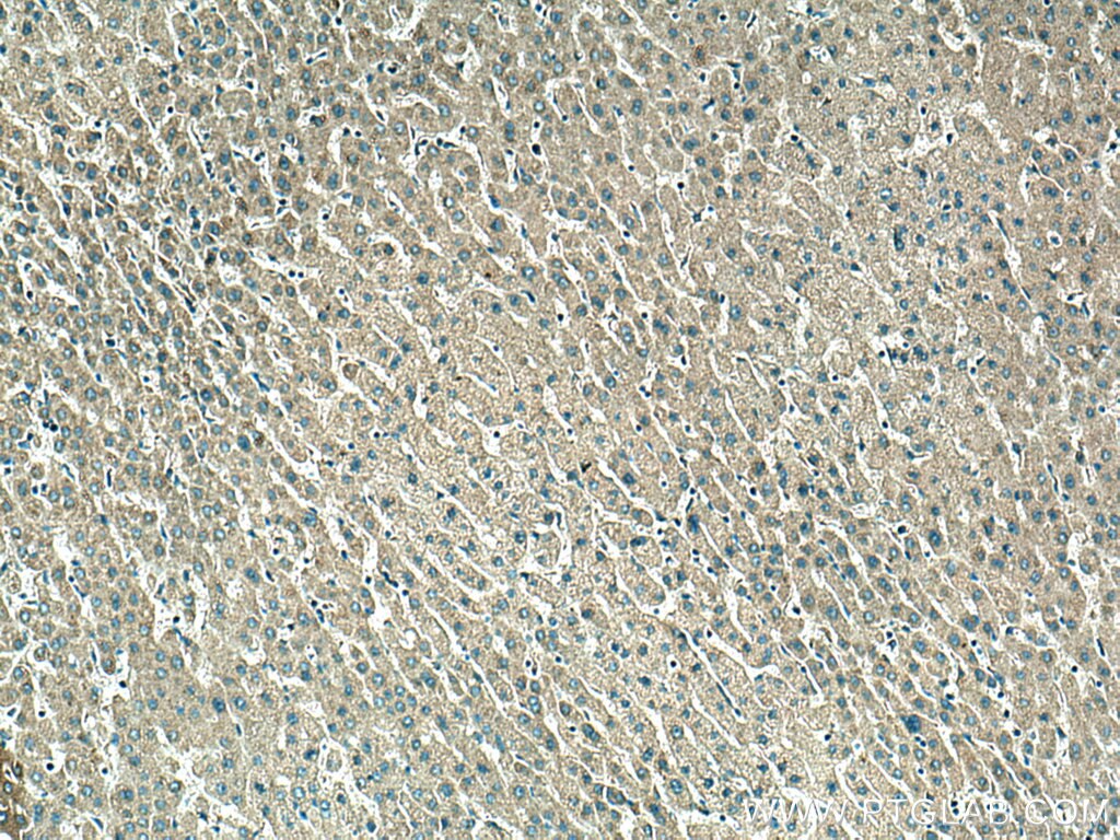 IHC staining of human liver using 20378-1-AP