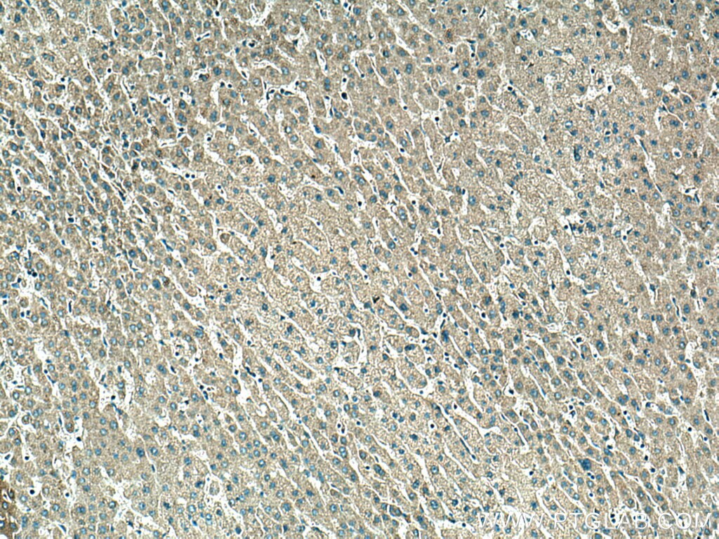 Immunohistochemistry (IHC) staining of human liver tissue using TMEM176A Polyclonal antibody (20378-1-AP)