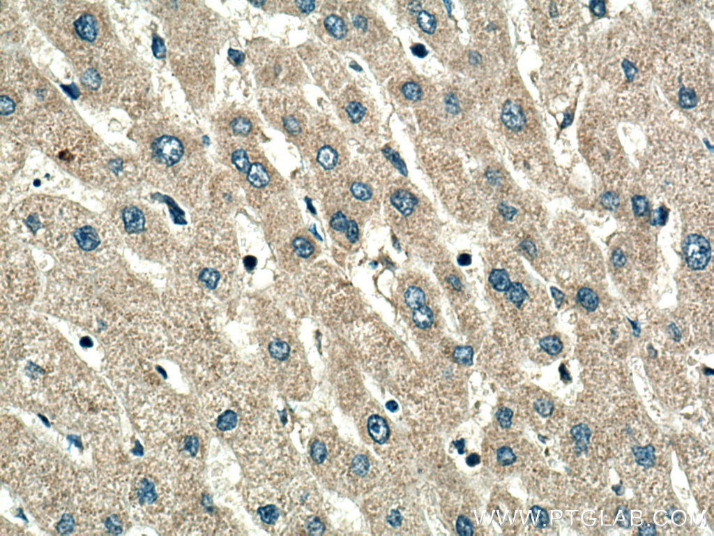 Immunohistochemistry (IHC) staining of human liver tissue using TMEM176A Polyclonal antibody (20378-1-AP)