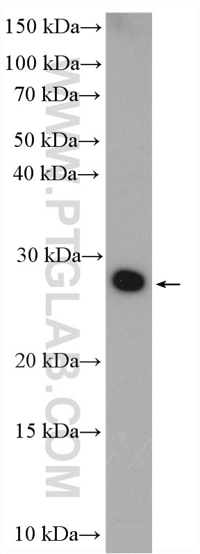 Western Blot (WB) analysis of fetal human brain tissue using TMEM176A Polyclonal antibody (20378-1-AP)