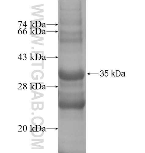 TMEM176A fusion protein Ag14194 SDS-PAGE