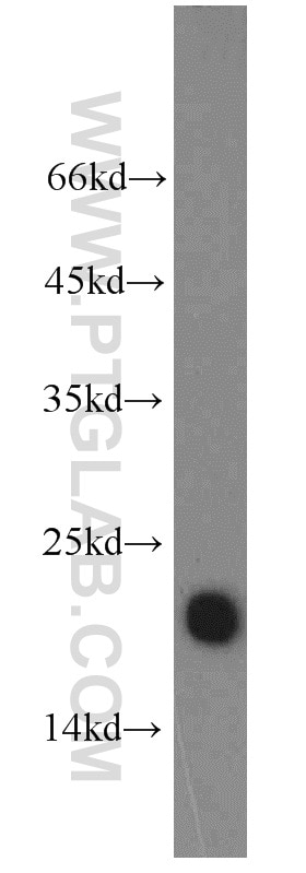 Western Blot (WB) analysis of A549 cells using TMEM176B Polyclonal antibody (19825-1-AP)