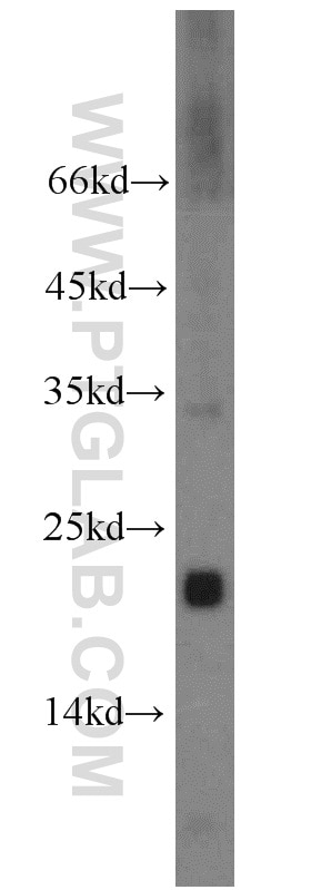 Western Blot (WB) analysis of human placenta tissue using TMEM176B Polyclonal antibody (19825-1-AP)