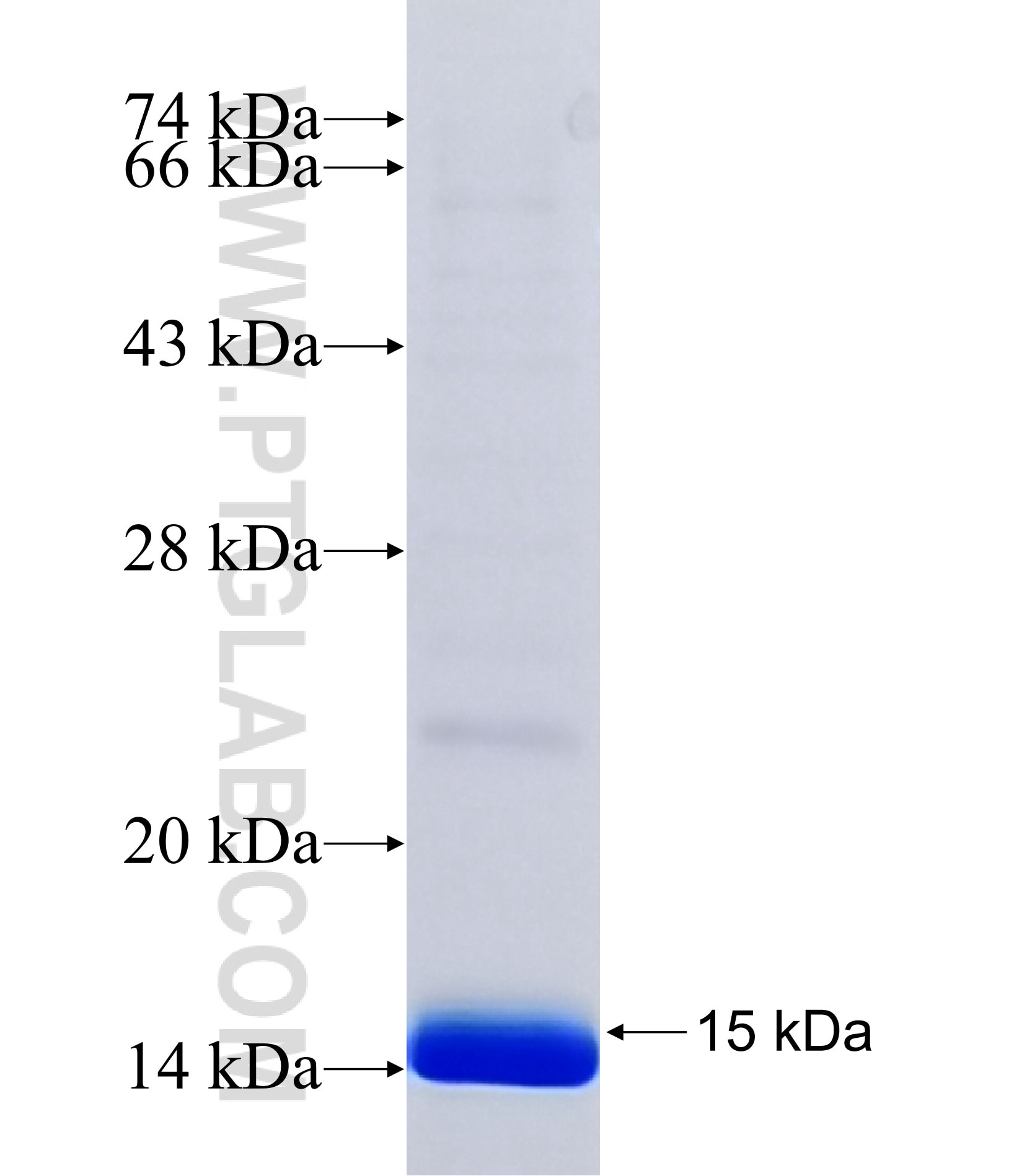 TMEM178 fusion protein Ag41895 SDS-PAGE TMEM178 fusion protein Ag41895 SDS-PAGE