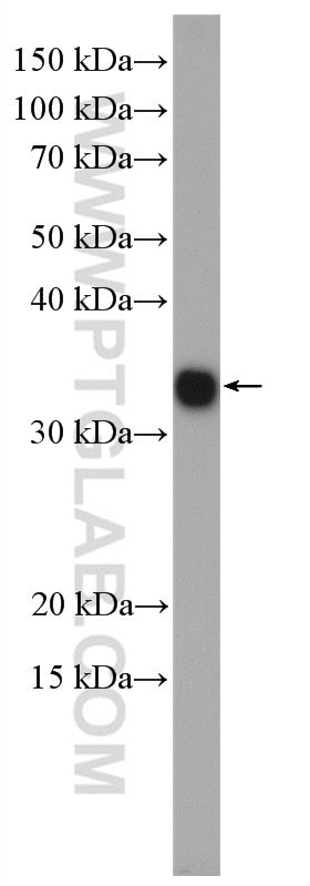 Western Blot (WB) analysis of mouse liver tissue using TMEM179 Polyclonal antibody (24799-1-AP)