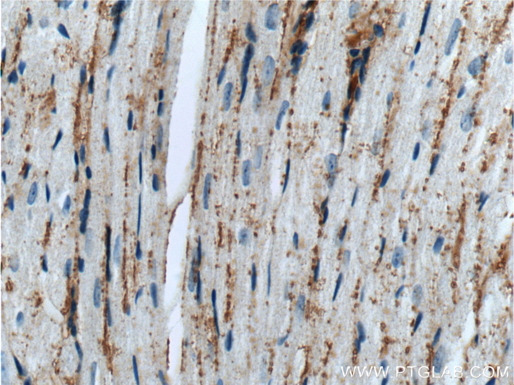 Immunohistochemistry (IHC) staining of mouse heart tissue using TMEM181 Polyclonal antibody (55411-1-AP)