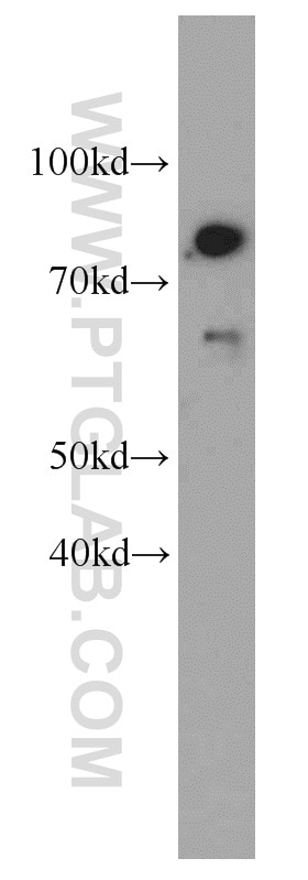 Western Blot (WB) analysis of A431 cells using TMEM181 Polyclonal antibody (55411-1-AP)
