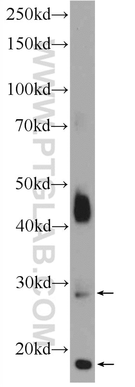 Western Blot (WB) analysis of mouse skeletal muscle tissue using TMEM182 Polyclonal antibody (25366-1-AP)