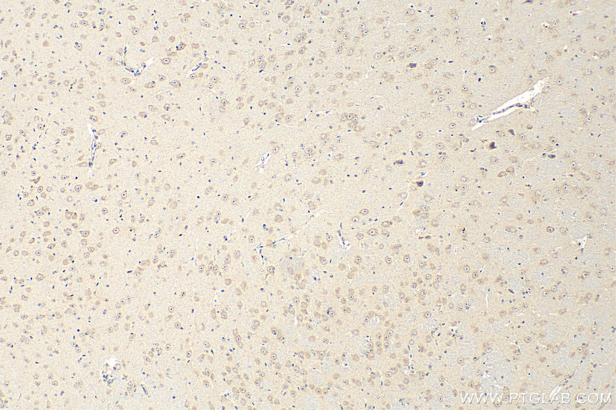 Immunohistochemistry (IHC) staining of mouse brain tissue using TMEM184B Polyclonal antibody (28031-1-AP)