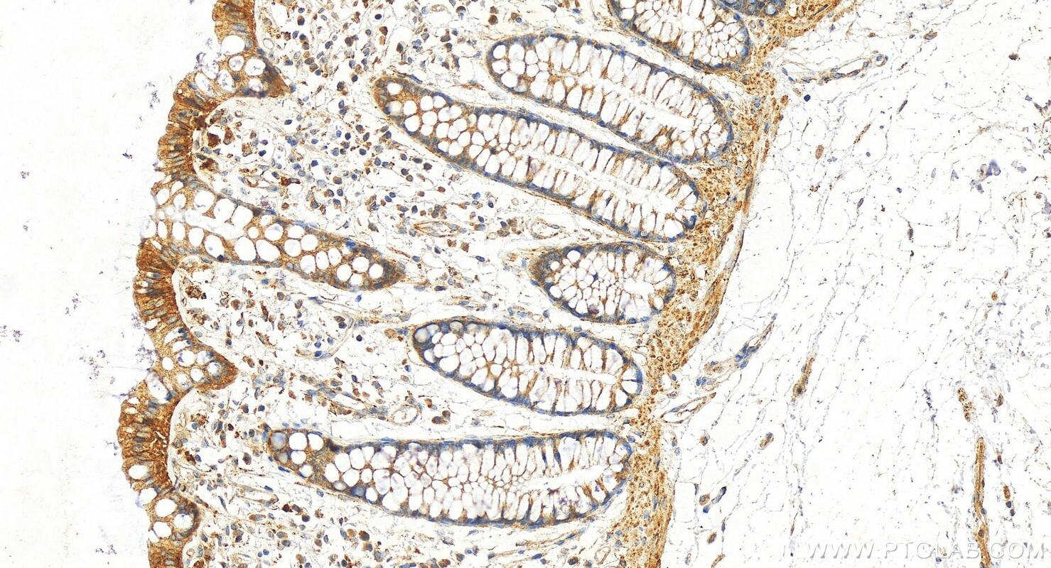 Immunohistochemistry (IHC) staining of human colon tissue using TMEM189 Polyclonal antibody (31293-1-AP)