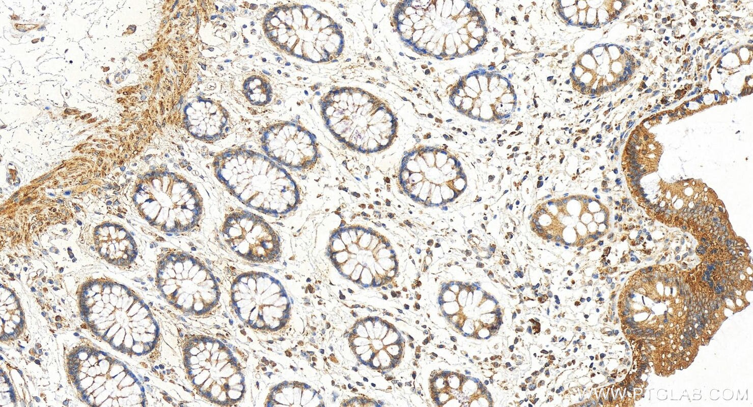 Immunohistochemistry (IHC) staining of human colon tissue using TMEM189 Polyclonal antibody (31293-1-AP)