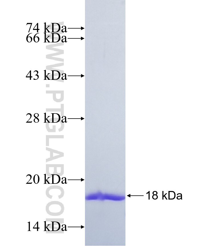 TMEM19 fusion protein Ag37193 SDS-PAGE