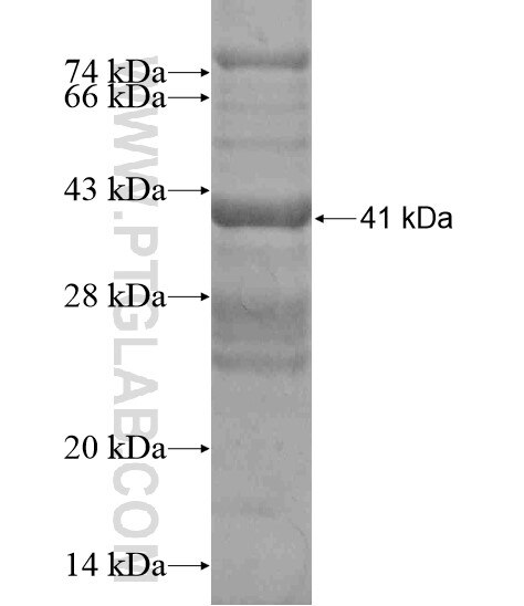 TMEM190 fusion protein Ag19076 SDS-PAGE
