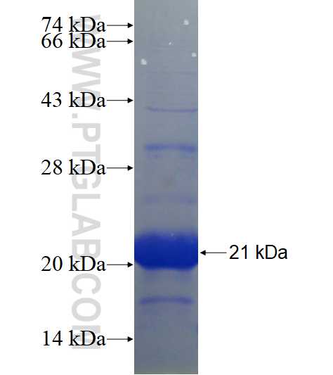 TMEM190 fusion protein Ag19131 SDS-PAGE
