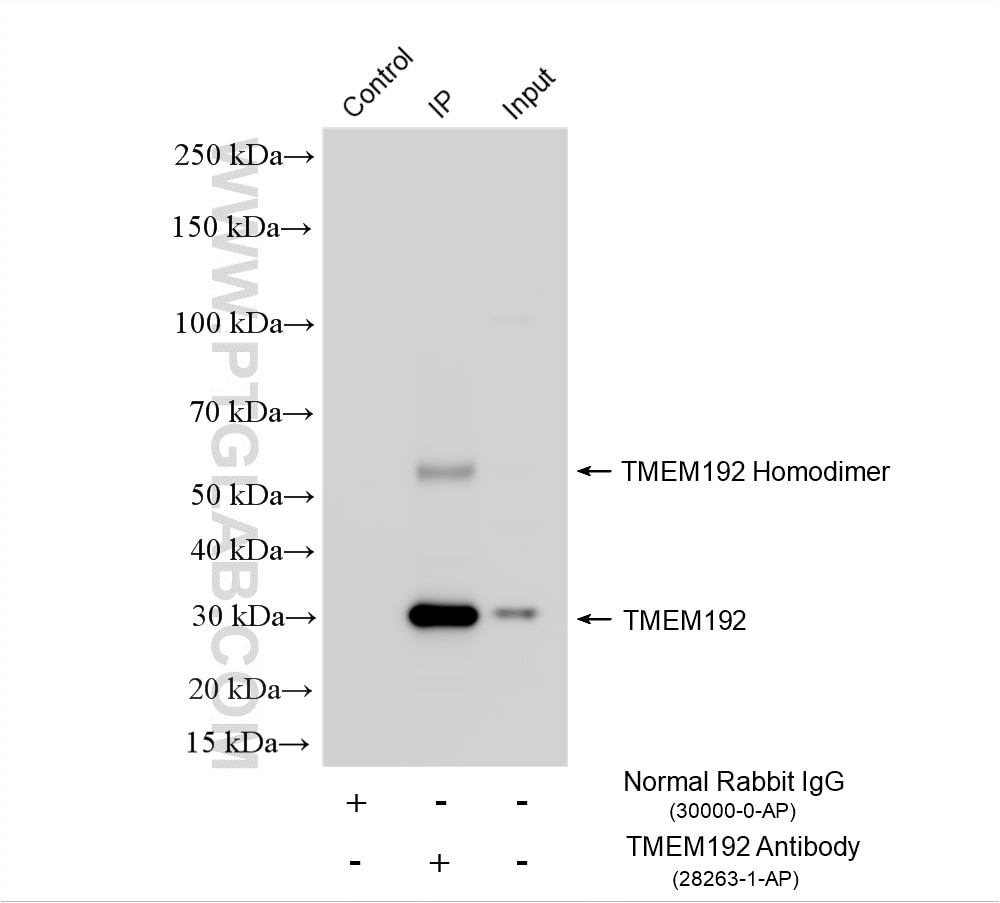 Immunoprecipitation (IP) experiment of A431 cells using TMEM192 Polyclonal antibody (28263-1-AP)