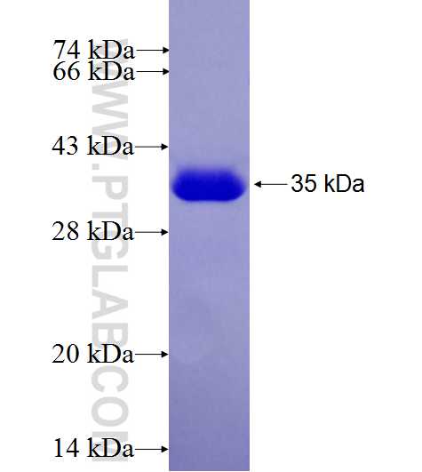 TMEM192 fusion protein Ag27576 SDS-PAGE