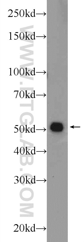 Western Blot (WB) analysis of MCF-7 cells using TMEM194A Polyclonal antibody (24477-1-AP)