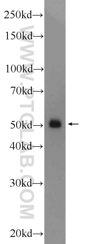 Western Blot (WB) analysis of mouse liver tissue using TMEM194A Polyclonal antibody (24477-1-AP)