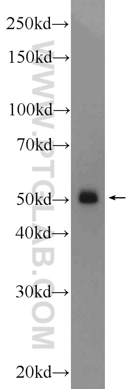 Western Blot (WB) analysis of mouse liver tissue using TMEM194A Polyclonal antibody (24477-1-AP)