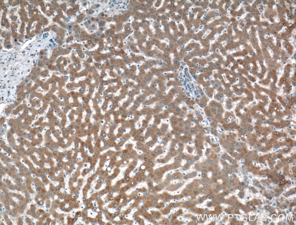 Immunohistochemistry (IHC) staining of human liver tissue using TMEM195 Polyclonal antibody (21355-1-AP)
