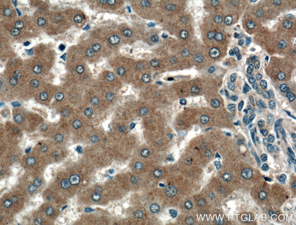 Immunohistochemistry (IHC) staining of human liver tissue using TMEM195 Polyclonal antibody (21355-1-AP)