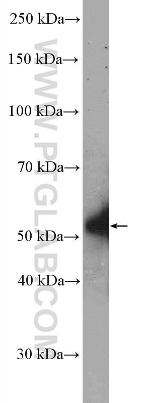 Western Blot (WB) analysis of mouse liver tissue using TMEM195 Polyclonal antibody (21355-1-AP)