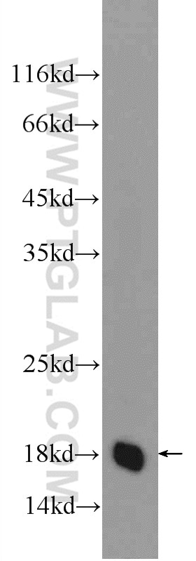 Western Blot (WB) analysis of NIH/3T3 cells using TMEM199 Polyclonal antibody (25489-1-AP)