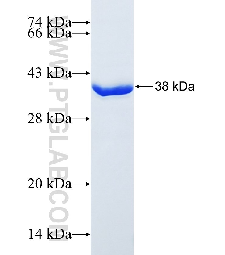 TMEM20 fusion protein Ag34357 SDS-PAGE